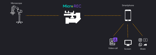 Workflow of an ophthalmologist recording surgeries with MicroREC