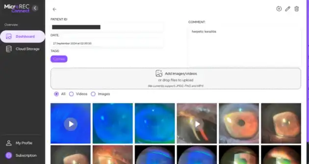 MicrotTo4K, optical system to attach professional cameras in any slit lamp